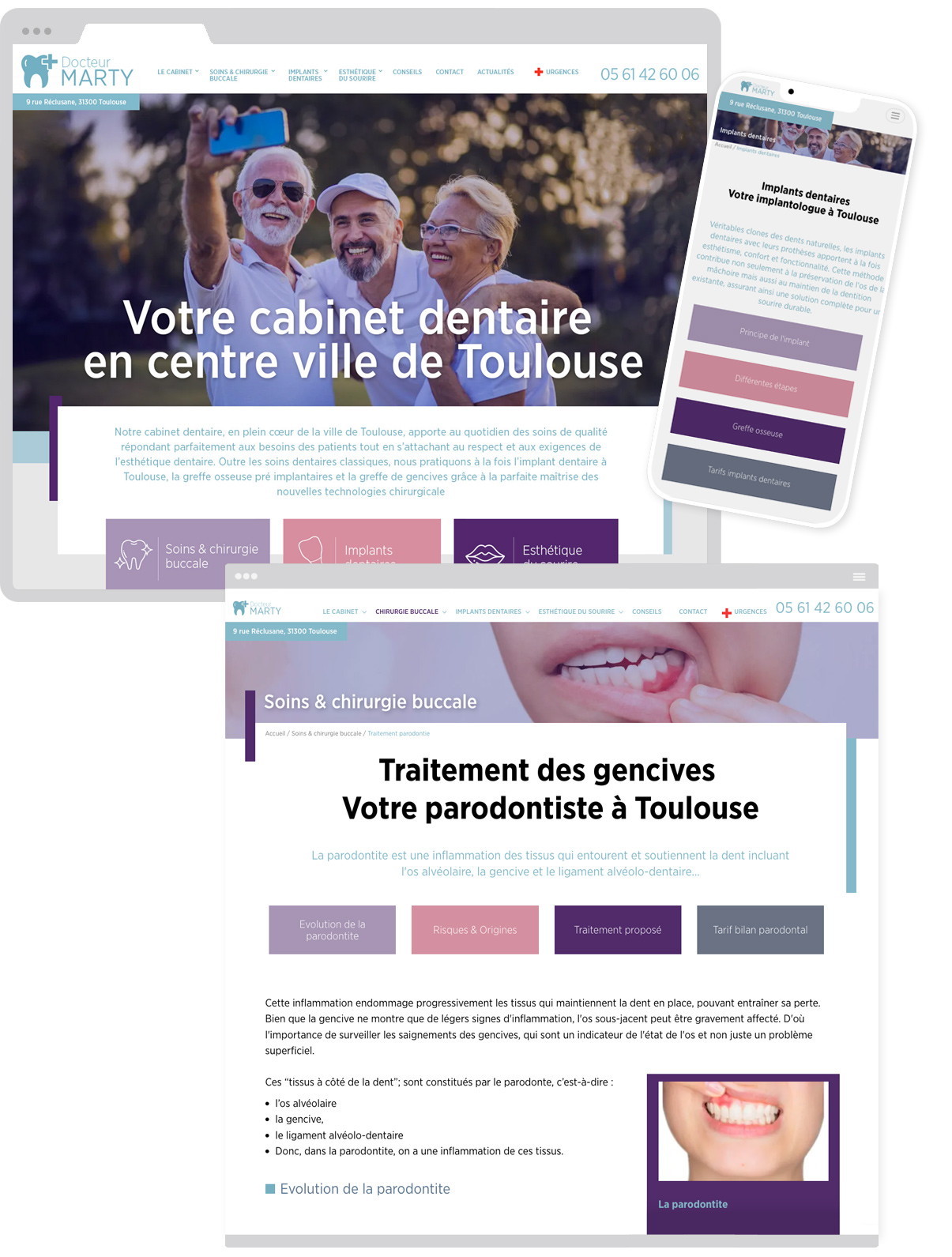 Docteur Marty - Implants dentaires - site internet - Toulouse - @ ovarma studio